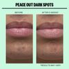Peace Out Dark Spots Microstructure Dots for Hyperpigmentation 2 Count Pack
