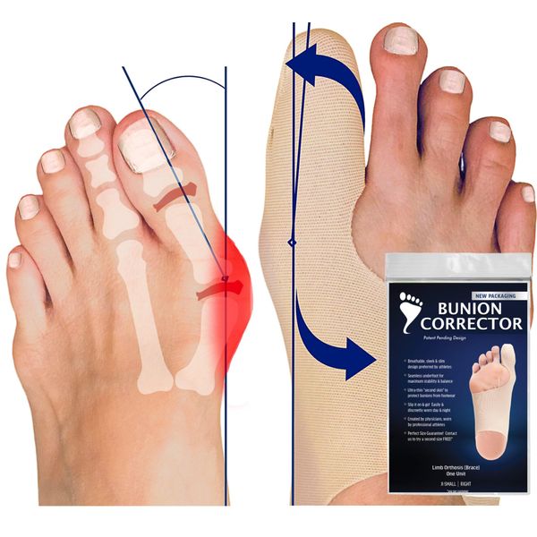 Bunion Bootie (New - No Toe Hole) (Medium, Right Foot)