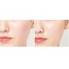 JMsolution Centra Care Modeling Mask Rescue 5 Masks