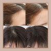 Hairline Powder Hair Root Touch Up, Instantly Conceals Hair Loss And Fills In Receding Hairlines Forehead Side Hair Filler Sweatproof Hairline Finishing Stick For Women Men (Medium Brown & Brown)