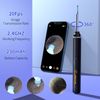 HD Ear Wax Removal Kit: 1920P Camera & 8-Piece Set for iPhone, iPad & Android
