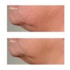 Perricone Perricone High Potency Classics Growth Factor Firming & Lifting Serum 30 ml