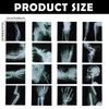 16 Pcs Broken Bones X-Ray Set, Black and White Skeleton Pretend X-Rays, 9.84" x 9.84"