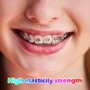 80 Pieces Multi-Color Orthodontic Ligature Ties Orthodontic Elastic 2080 O-Rings Braces Bands