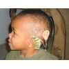 Ear Gear Cochlear Cordless – Protect Implants from Dirt, Sweat, Moisture, Wind – Fits Most Cochlear, Advanced Bionics, and Medel Processors