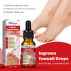 Ingrowth Toenail Correction Treatment Oil, Ingrown Toenail Treatment Kit, Correction Ingrown Toenail Drops, Cuticle Nail Oil Nail Fungal Treatment for Ingrown Toenail, with Glass Nail File