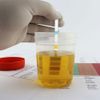 1Box(100Pcs)  Urine Test Strips 10 Parameter Reagent Tests Health Care, UTI, pH