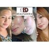 Beautederm Trial Beaute Set (Good for 1 month)