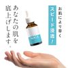 Niacinamide High Concentration 15% Formulated Beauty Serum, 1.0 fl oz (30 ml), Plus Moist NA15