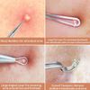 Professional Blackhead Remover Set Stainless Steel 11 Heads Tools