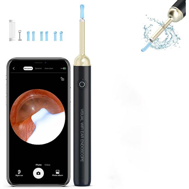JOYSMAZY Ear Wax Removal - Ear Cleaner with Camera, Earwax Removal Kit with 8 Pcs Ear Wax Remover Tool for Adults, Kids, Pets
