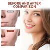 Xumann 2PCS Collagen Peel Off Mask for Elasticity Hydration Care (60g/Pcs)