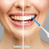 220 Pieces Interdental Brushes, Silicone Dental Brushes Blue Tooth Floss Picks for Braces Oral Cleaning