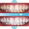 Purean Teeth Whitening Oxystrips - 40 Pure Atomic Oxygen Releasing White Strips - 20 Treatments