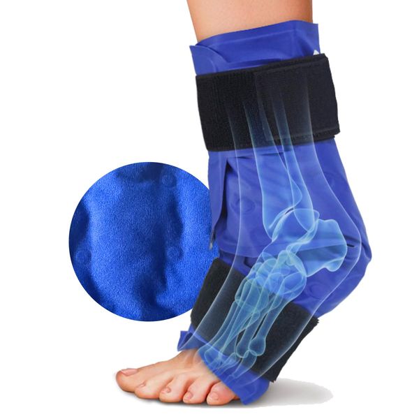 Ankle Ice Pack Wrap with Hot/Cold Gel Packs by | Foot Pain Relief for Achilles Tendon Injuries, Plantar Fasciitis, Surgery Recovery，Bursitis & Sore Feet | Microwaveable (2 x Reusable Ice Gel Pack)