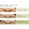 Eyebrow Specialty Brand Luvi Eyebrow Medicated Hair Growth Essence Quasi-Drug