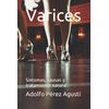 Varices: Síntomas, causas y tratamiento natural