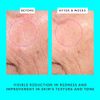 Drunk Elephant Bouncy Brightfacial Leave-On Face Mask with Azelaic Acid and Salicylic Acid to Correct and Clarify Skin (50mL / 1.69 Fl Oz)