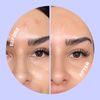 UNDERCOVER Blemish Patches
