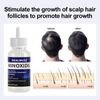 2Pack Minoxidil 5% Extra Strength Men 2 Month Supply Hair Regrowth Solution 50ml