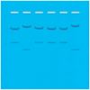 DNA Fingerprinting by Restriction Enzyme Patterns,Group Size for 8 Gels