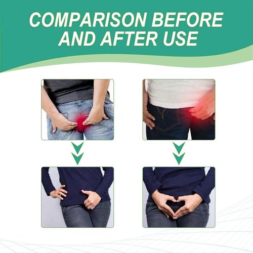 Herbal Hemorrhoids Cream MediLisk,Pile Cream Hemorrhoids,Natural Hemorrhoids Treatment,Hemorrhoid Treatment Cream,Maximum Strength Pain Relief,Natural Fast Pain Relief Cream,Piles Treatment Cream