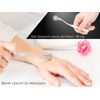 Nerve Wheel Needle Wheel Nervous Wheel to Wait Berg