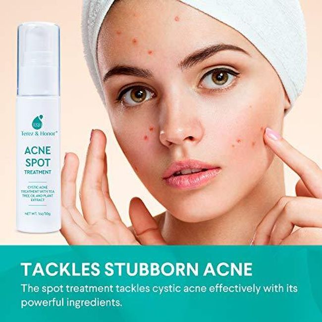 Acne Spot Treatment for Acne Prone Skin - Treats Cystic Acne, Advanced Acne Removal