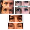 Instantly Ageless 20 Vials Facelift & Wrinkle remover in seconds