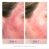 iS CLINICAL Pro-Heal Serum Advance+ Antioxidant-Rich Serum With Vitamin C, E, and A for Redness, Inflammation, Wrinkle-Smoothing, Sun Damage Repairing - 1 Fl Oz