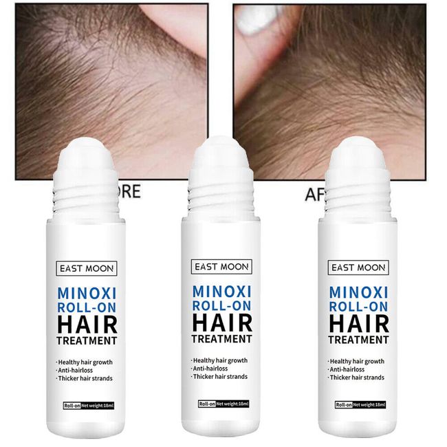 3x Hair Growth Roll-on Hair Treatment, 2023 Hair Growth Serum Hair Treatments