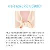 【指定第2類医薬品】ジーフォーL軟膏 20g