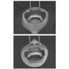 Osung Dental Vestibulum Lip Retractor - RTCRC