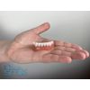 Instant Smile Handmade Bright White Lower Veneer