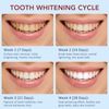 SP-6 Probiotic Whitening Toothpaste Refresh Mouth Brighten Remove Yellow Tooth