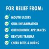 Colgate Peroxyl Mint Flavour Mouthwash, 300ml