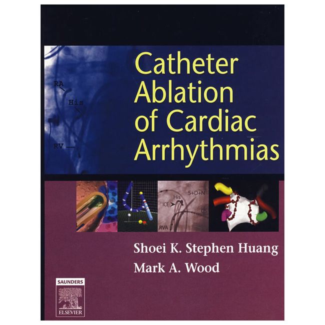 心律不齐导管消融Catheter Ablation of Cardiac Arrhythmias