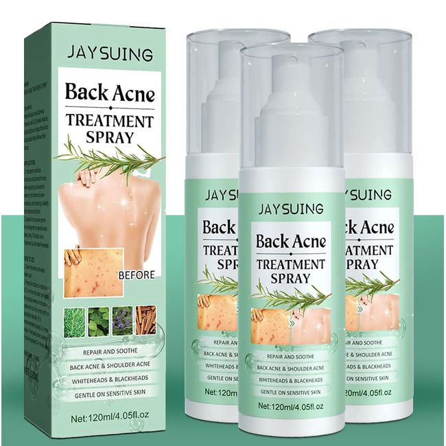 3 Pack Back Acne Treatment, Back Acne Spray, 2% Salicylic Acid Spray, Body Acne Treatment with Herbal Formula, Body Acne Spray, Tea Tree Oil Spray, Acne Treatment For Teens, Back Acne Solution