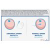 SPERM BOOSTER - Increase Sperm Count - Powerful Ejaculations - to Treat & Preven