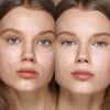 KIKO Milano Full Coverage Concealer 01 | Concealer with Very High Coverage