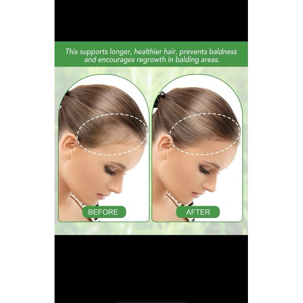 Pure Organic Rosemary Oil 30 Ml