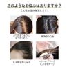 HIYE ウィッグ 人毛100% 頭頂部 自然 分け目 つむじ付き 軽量 トップカバー 部分ウィッグ セミロング 白髪隠し 薄毛隠し 増毛 前髪 かつら 女性 小顔 円形脱毛症 医療用ウィッグ 黒髪 横9cm縦14cm (30CM-栗色)