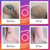 Foundation Tape, Tattoo Concealing Stickers, Select from 4 Colors and 3 Sizes, LoginMyLife