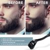 Derma Roller 1.5mm SILVER Needles, ONLY for Professional Users, 540 Microneedle roller for Beard and Hair Growth, Anti-Aging Stretch Marks Scars