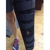 OSSUR Universal 3-Panel Knee Immobilizer Lightweight Black 24" Inch 200030 NEW