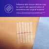 3M SteriStrip Adhesive Skin Closures R1542