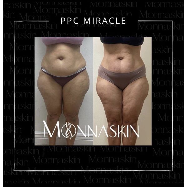 MESOLIPO PPC Cream Monnaskin 50g