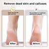Callus Remover Replacement Rollers, Extra Coarse Mineral, Diamond Particles, 12-Pack, 3 Roughness Levels