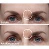 Dermaflage Scar Filler Refill, 4 Applicators