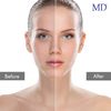 MD Enzyme Peeling Mask